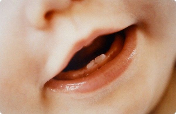Прорезывание зубов у малыша. Как облегчить ребенку прорезывание зубов?