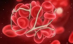 Консультация по заболеваниям периферических артерий